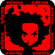 edema